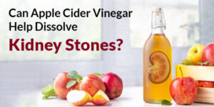 Read more about the article Can Apple Cider Vinegar Help Dissolve Kidney Stones?