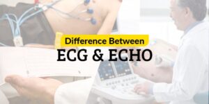 Read more about the article The difference you need to know between ECG and ECHO